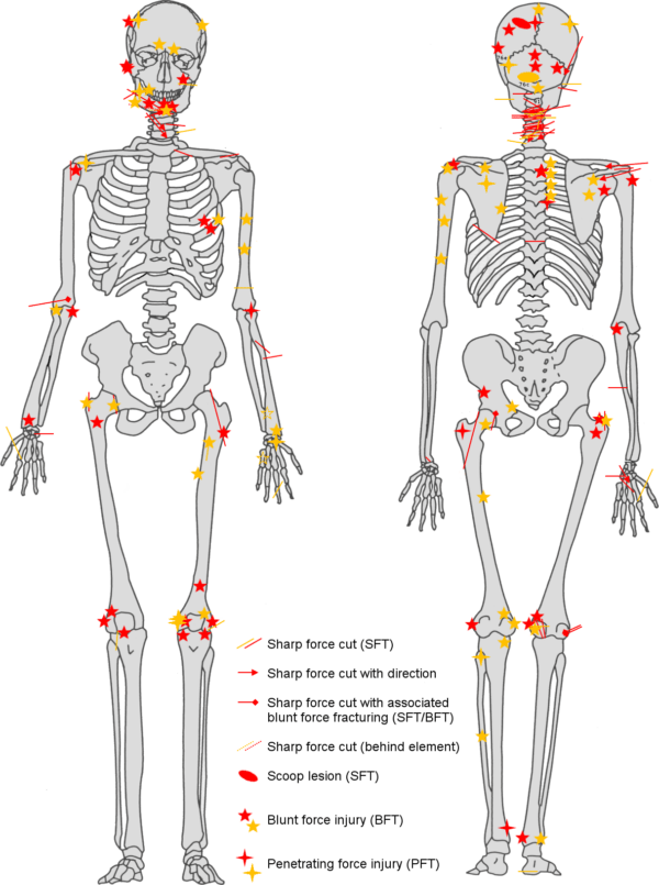 A diagram shows the extensive injuries suffered by one Crusader.