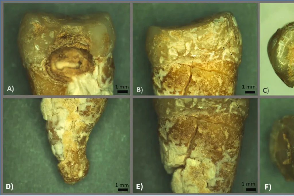 Optical microscope images of the archaeological upper premolar tooth. Credit: Paula Kotli / Journal of Archaeological Science: Reports